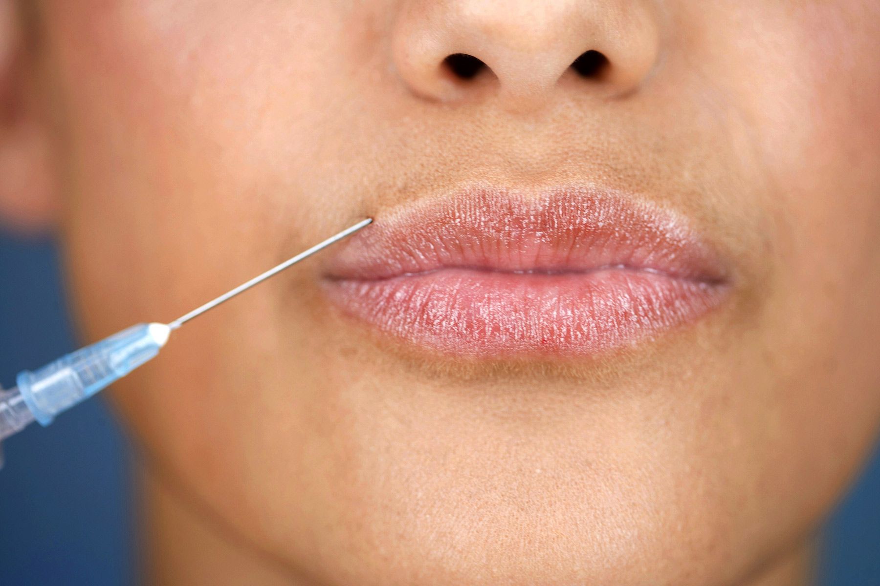 What Are Injectable Facial Fillers?