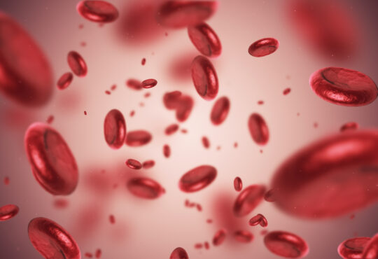 What are the simple tips to cure anaemia, and when do you have to take medicines?